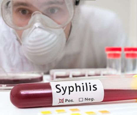 Care sunt primele semne ale sifilisului