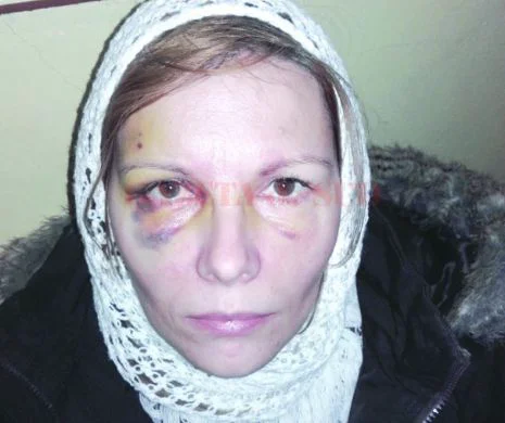 Drama unei femei din Craiova bătută și maltratată de soț ani de zile în fața copilului