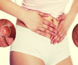 Cum se previne și se depistează din timp cancerul care omoară cele mai multe românce