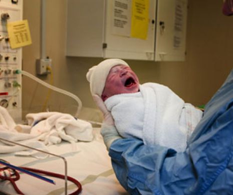 Bebeluș cu claviculă ruptă la naștere