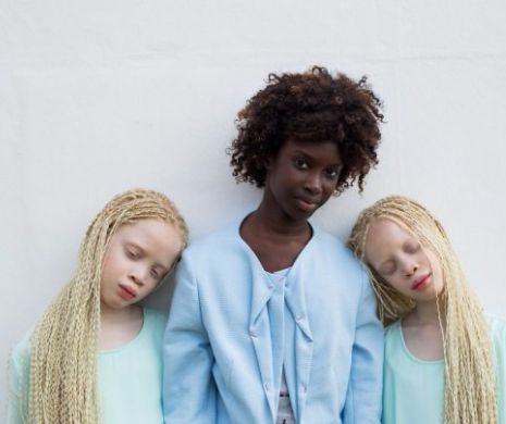 Imagini uluitoare cu o pereche de gemene albino care schimbă industria modei
