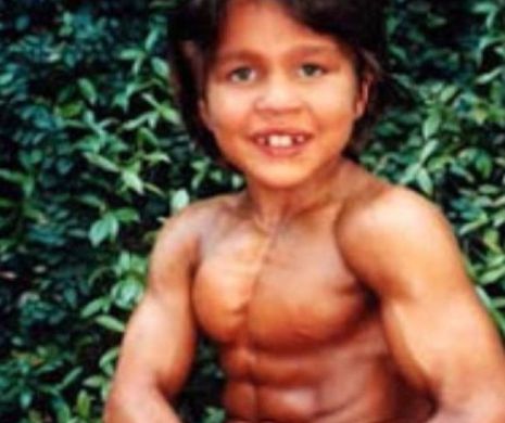Transformarea șocantă a „Micului Hercule”. Cum arată băiatul cu cei mai mari mușchi din lume la 24 de ani. Foto în articol