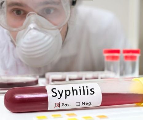 Primele simptome ale sifilisului!