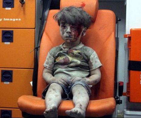 Cum arata acum Omran, copilul-simbol din Siria