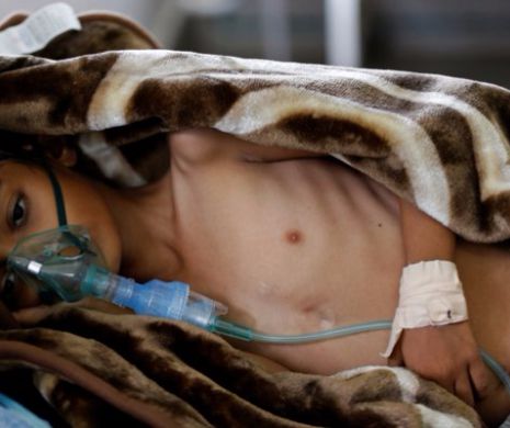 1992 de oameni au murit în Yemen din cauza holerei