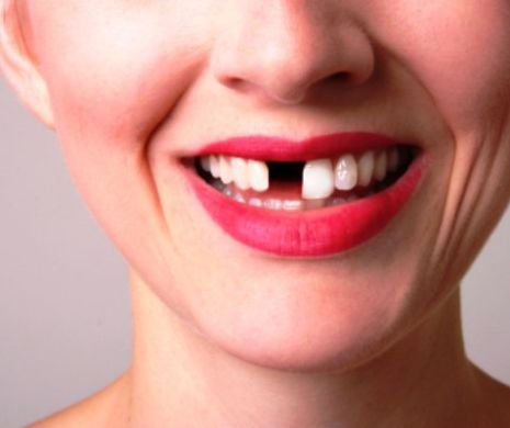 Alarmant: românii vin la dentist doar când le cad dinții! Ce recomandă stomatologii