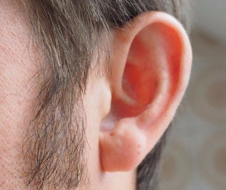 Cum se elimina dopul de ceară din ureche fără a leza timpanul