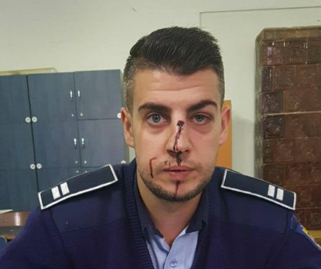 Polițist cu nasul spart de un smecher din Balș care este suspect de tâlhărie