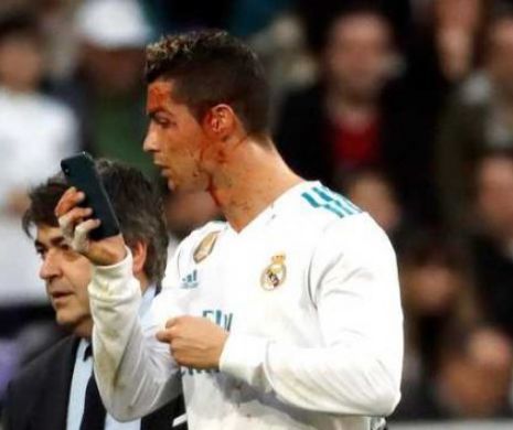 FOTBAL EUROPEAN. Real Madrid A ZDROBIT echipa la care evoluează Florin Andone. Plin de SÂNGE, Ronaldo a făcut un SELFIE pe teren