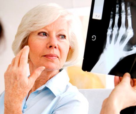 TRATAMENTUL pentru artrită care va REVOLUȚIONA medicina. Milioane de oameni ar putea fi AJUTAȚI