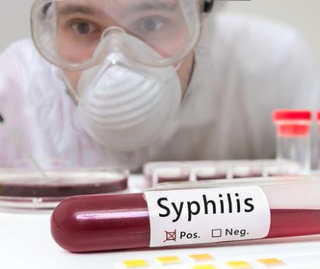 Sifilis. Simptome, cauze și tratament