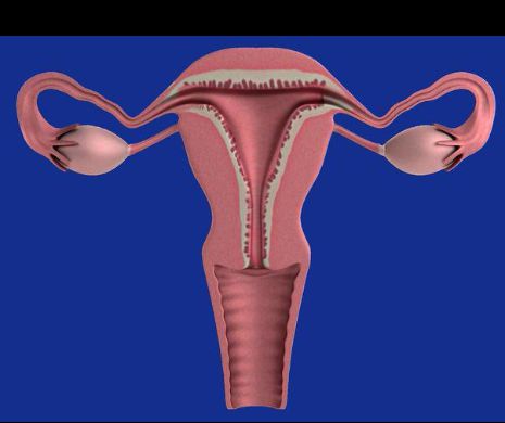 Două simptome care iti spun ca ai cancer ovarian. Nu le ignora!