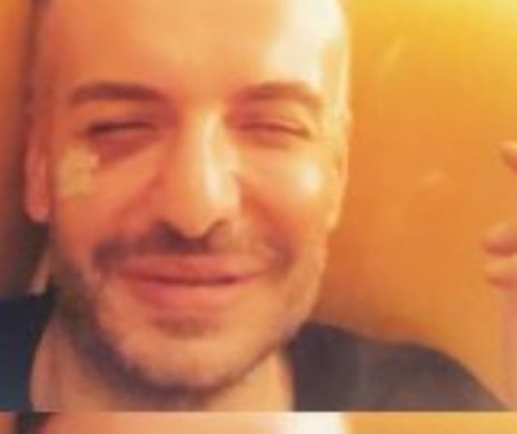 Reacţia lui  Răzvan Ciobanu după ce s-a împrăştiat zvonul că ar fi fost BĂTUT de fostul iubit