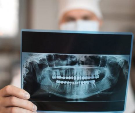 Un dentist suedez a fost CONCEDIAT și AMENDAT după ce a DOVEDIT că 80% dintre migranții COPII sunt ADULŢI. Ce i s-a întâmplat mai departe este strigător la cer