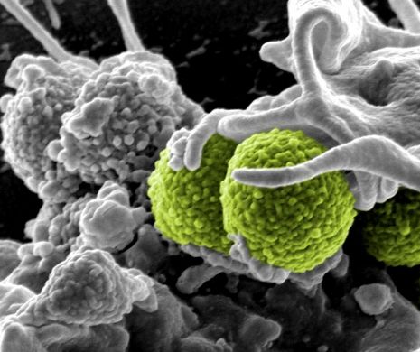 ALERĂ MONDIALĂ! O bacterie PERICULOASĂ riscă să se RĂSPÂNDEASCĂ în cel mai scurt timp în spitale. Este MORTALĂ și IMUNĂ la antibiotice