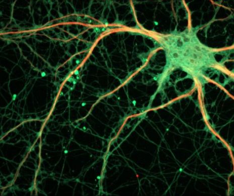 Neuronul pe care îl avem doar noi. Clubul de ȘTIINȚĂ