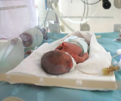 Bebelușul de 990 g REFUZAT de maternități, salvat la Timișoara. Medicii spun că e ”stabil” acum