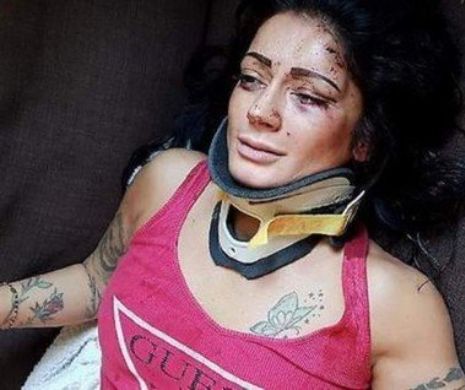 O balerină româncă din Italia a fost bătută cu BESTIALITATE în propria casă