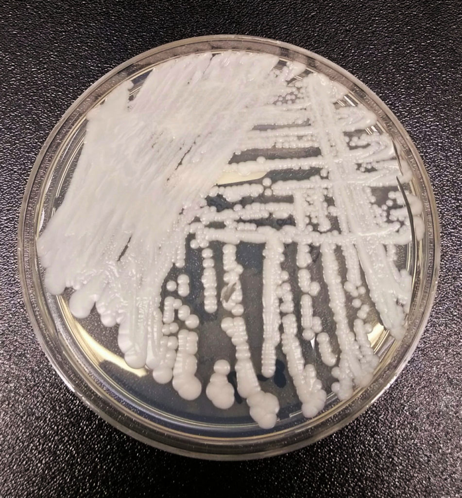 Candida Auris, ciuperca ucigașă rezistentă la antibiotice şi se răspândește odată cu încălzirea globală