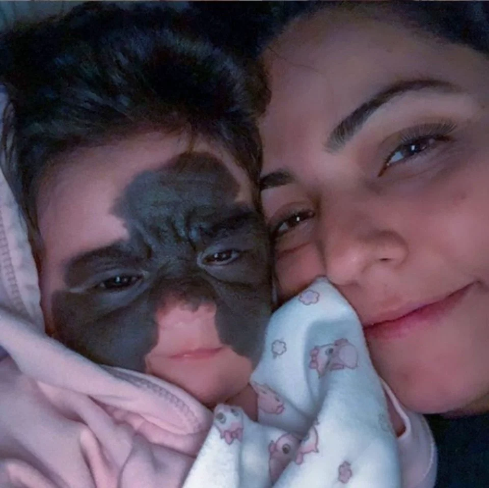 O fetiţă se naşte cu o pată neagră pe faţă. Social media a reacţionat fără milă