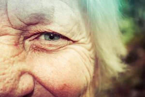 Cum se formează ridurile. Procesul inevitabil odată cu înaintarea în vârstă
