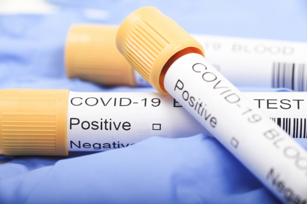 A început testarea! Ce județ din România a făcut deja primele teste de Coronavirus?