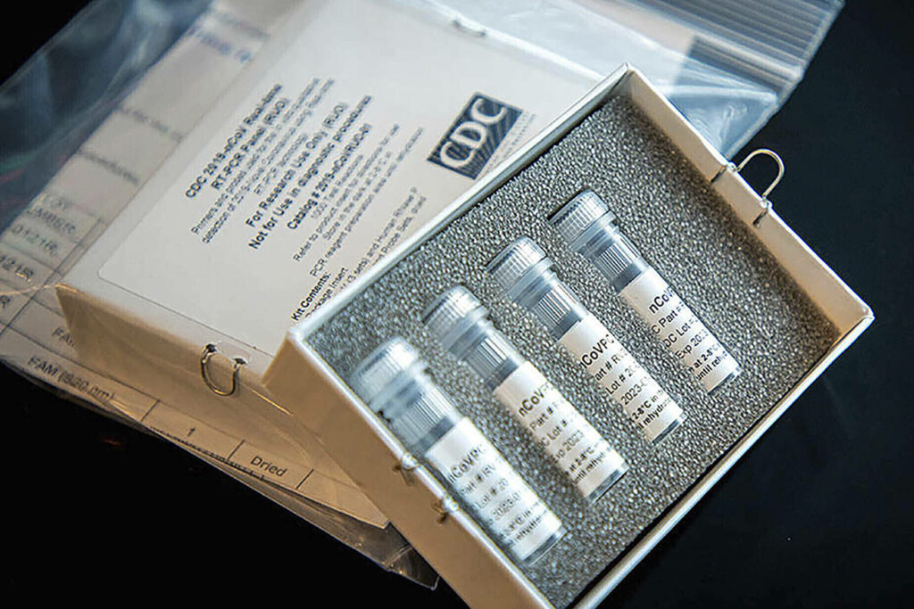 Bill Gates are propriul kit de testare pentru coronavirus. Îl poți folosi acasă