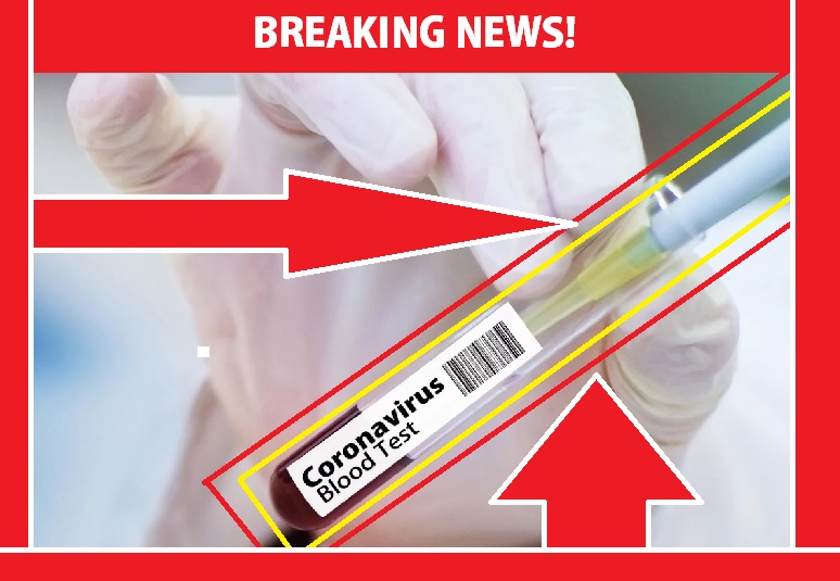 LE SOIR: Coronavirus: începerea unui test clinic european pentru patru tratamente