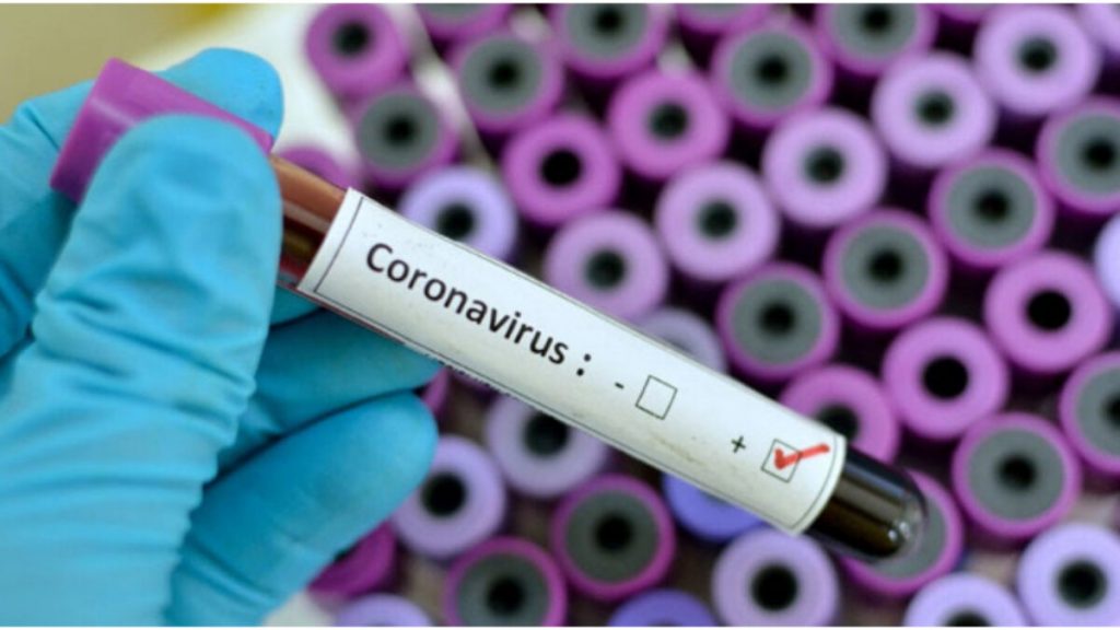 20 MINUTES: Coronavirus: Pandemiile se vor înmulți și vor provoca tot mai multe decese, avertizează ONU