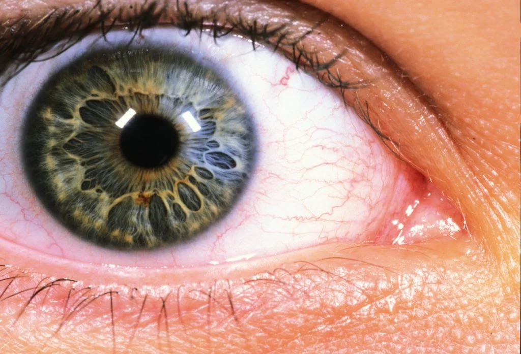 Covid-19 poate genera pierderea vederii. Prestigioasa revistă Radiology a publicat studiul