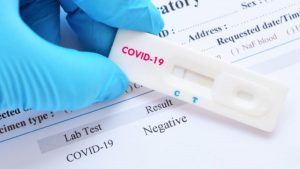 COVID-19 poate afecta bărbații într-un mod neașteptat. Ar putea avea probleme mari