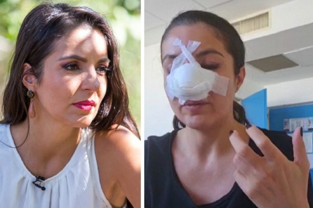 Femeia care i-a spart nasul designerului Cristina Joia a fost condamnată la închisoare. Conflict pornit de la un loc de parcare