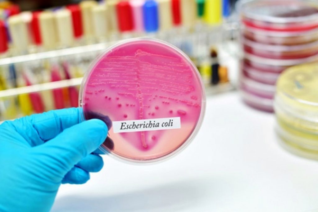 Bacteria ucigașă E.Coli a fost modificată genetic. Nu mai poate transmite alte boli grave