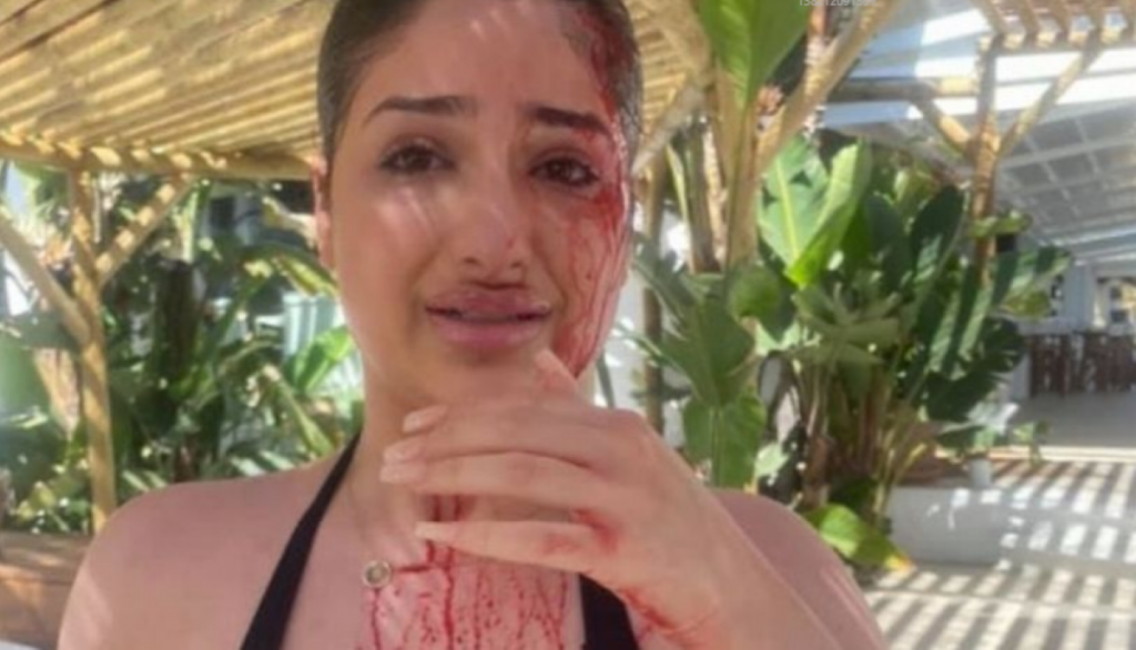 Vacanță de coșmar la un resort din Marbella. Studente atacate, una din ele rănită la cap