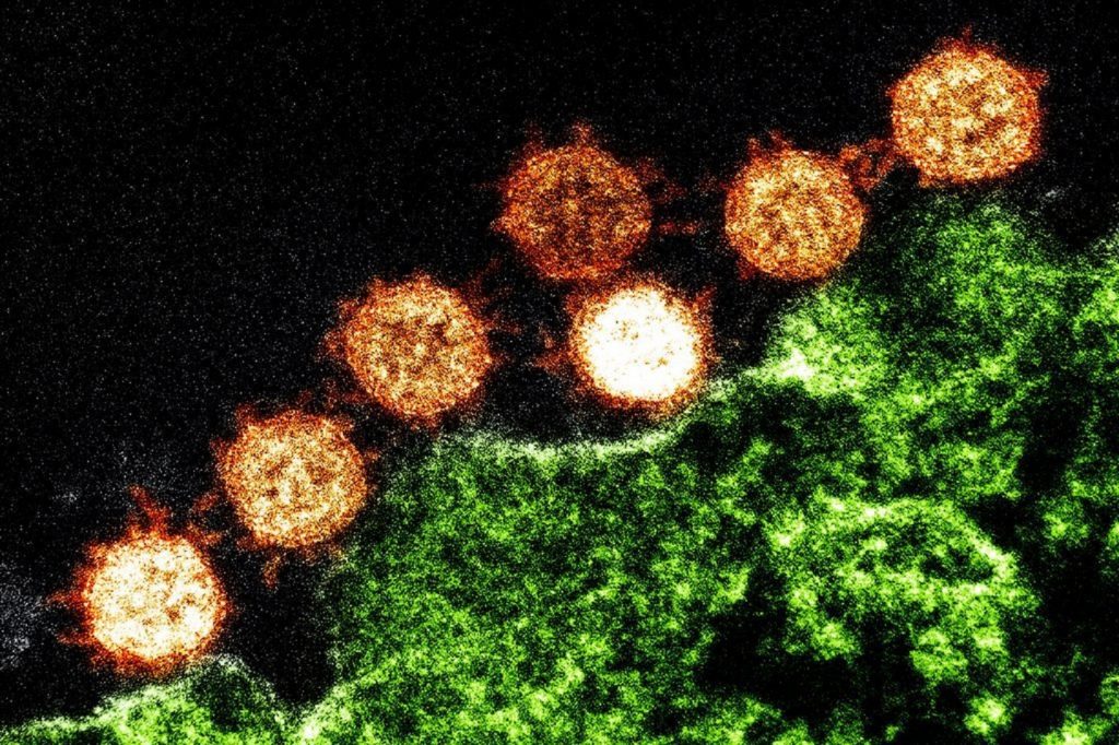 Rezultatul ultimelor cercetări. Tulpina Delta accelerează pandemia. Cine sunt cei mai expuși