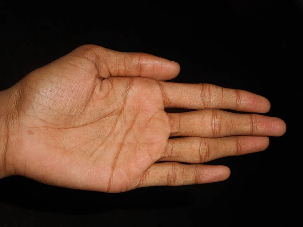 Un bărbat i-a cerut medicului să-i taie două degete sănătoase