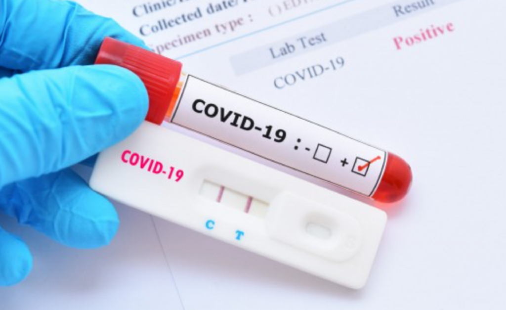 Cercetătorii români au dezvoltat un test revoluționar, care nu dă greș și depistează coronavirusul. Precizia e de 100%