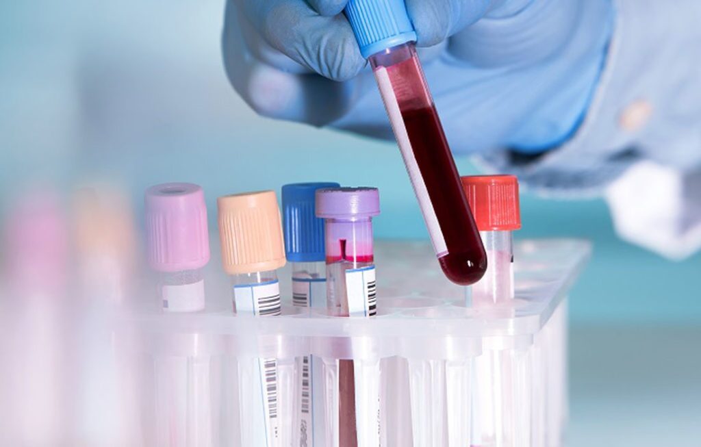 Bolnavii refuză transfuziile dacă nu sunt cu „sânge pur”. O nouă afacere profitabilă