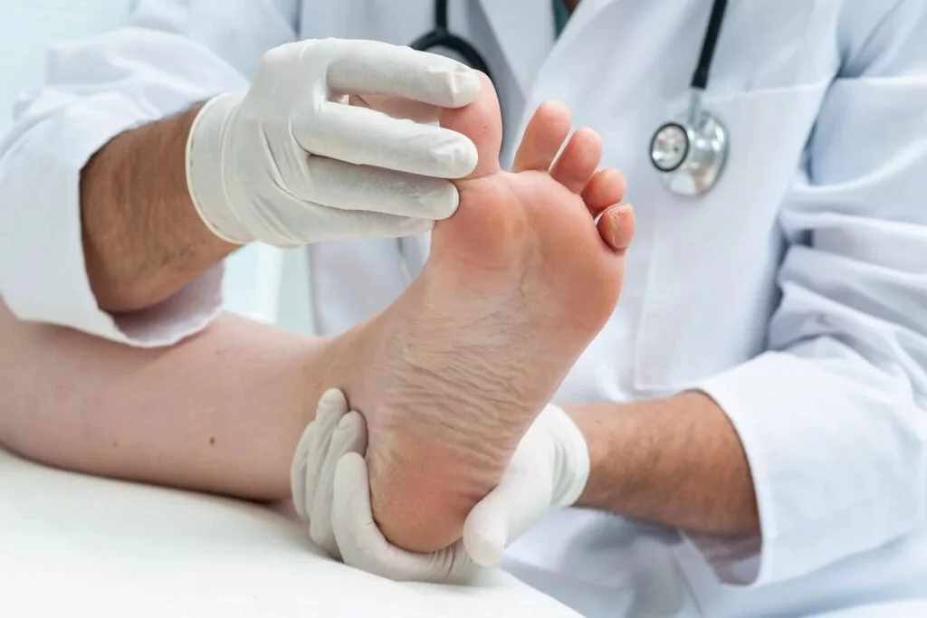 Semnele pe care le observați la picioare dacă vă confruntați cu diabetul