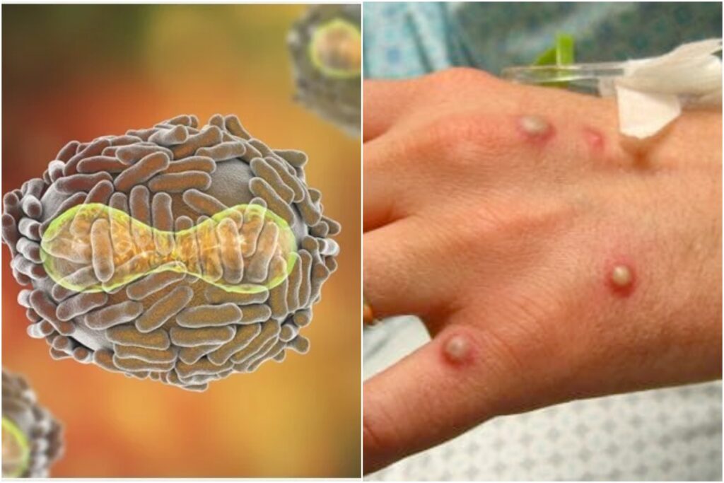 Care sunt simptomele variolei maimuței la animale. Pericolul e uriaș