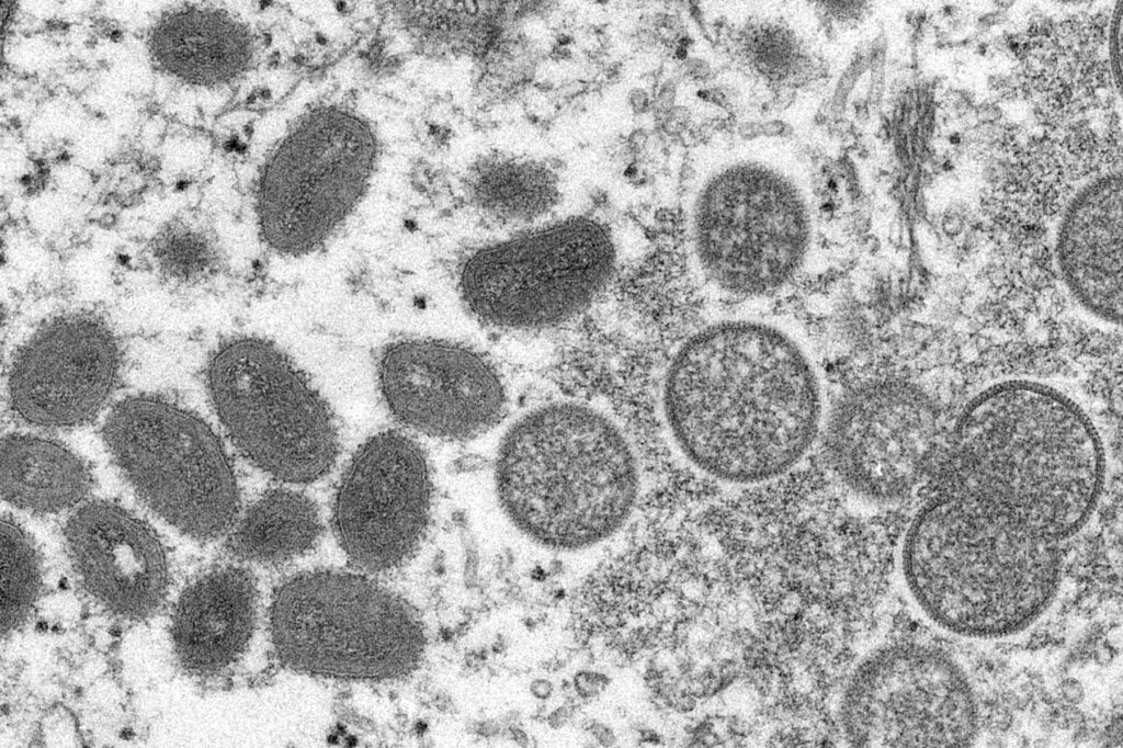 Update. Un nou caz de variola maimuței în România. Am ajuns la 5. Pacientul de 37 de ani, izolat la domiciliu
