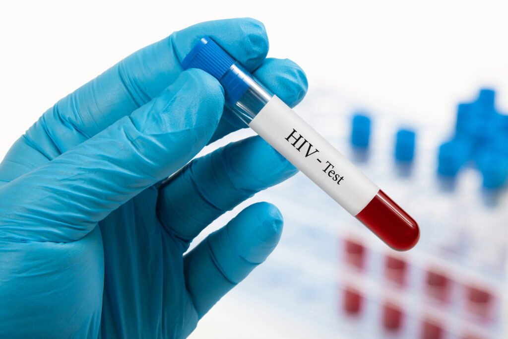 O combinație de vaccinuri ar putea fi esențială împotriva SIDA. Cooperare internațională pentru un studiu finanțat de Fundația Gates