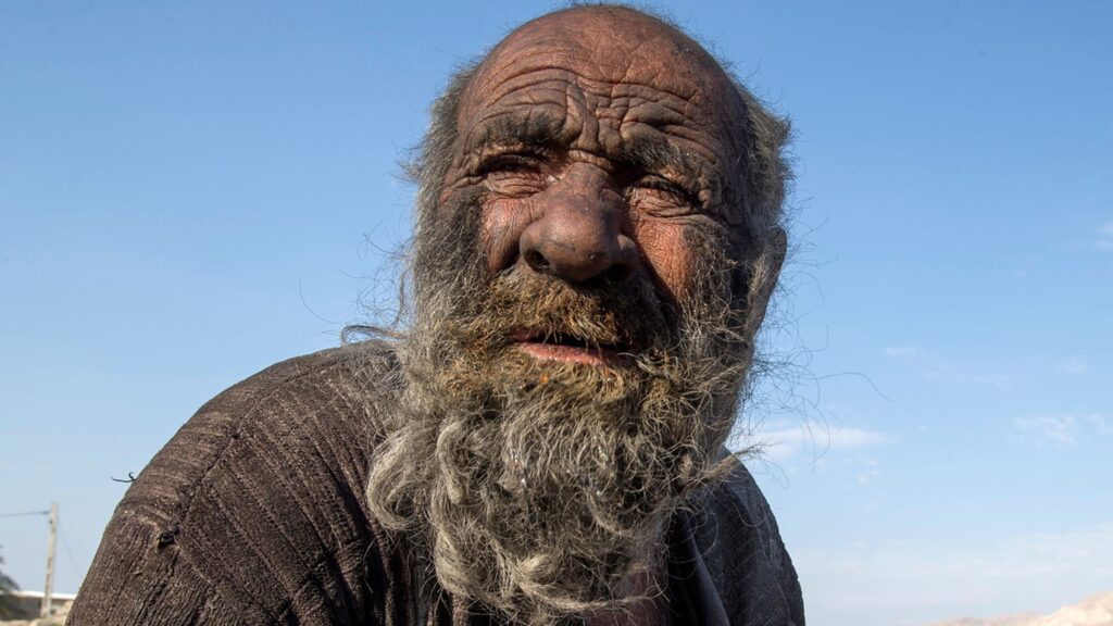Amou Haji, „cel mai murdar om din lume”, a murit la 91 de ani. Motivele pentru care nu s-a spălat timp de șase decenii