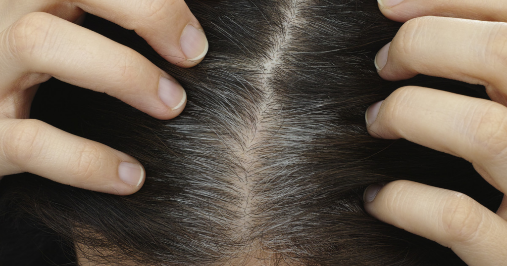 Principalele cauzele ale albirii premature a părului. Unele persoane sunt mai predispuse decât altele