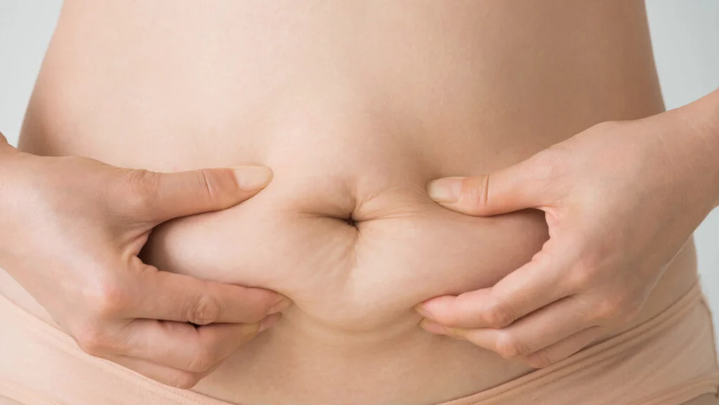 Grăsimea de pe abdomen produce factori de inflamație. Riscurile sunt mari