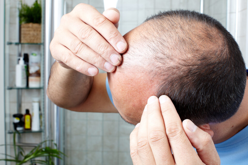 Tratament pentru căderea părului. Această tehnică provine din medicina ayurvedică