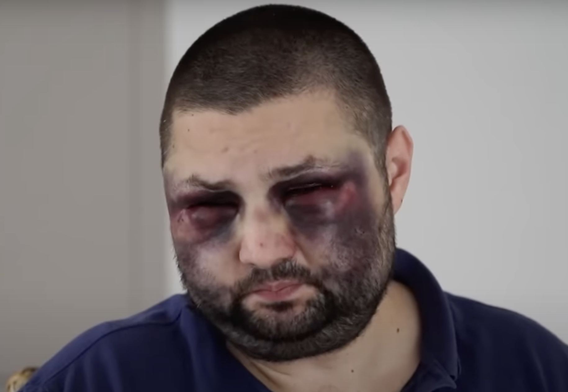 Andreas Jurca, politician român al AfD, bătut cu brutalitate