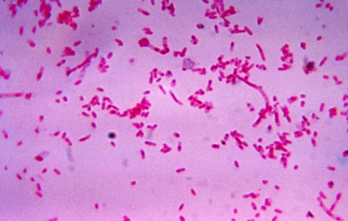 Descoperirea revoluționară: Bacteria Fusobacterium este eficientă în tratarea cancerului de cap și gât