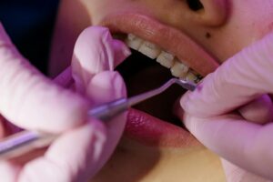 Cât de confortabil poate fi un aparat dentar?