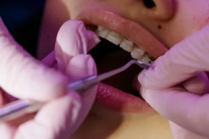 Unde găsești dentist în Halkidiki și cum faci rost de antibiotice